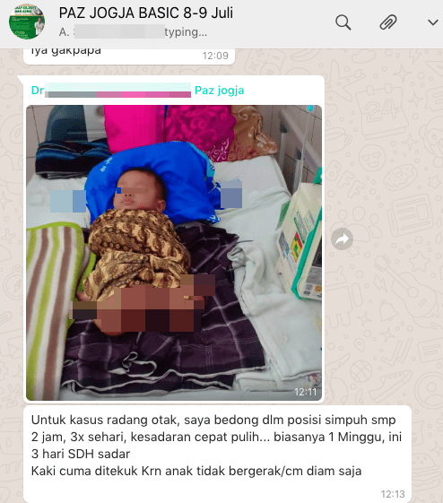 Terapi bedong paz pada keluhan peradangan otak menyadarkan anak