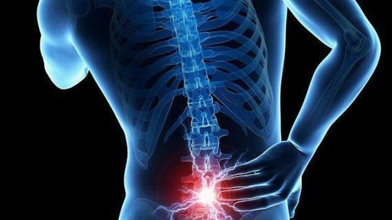 Pengobatan Syaraf Terjepit di Leher Secara Alami