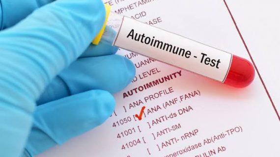 Autoimun Apa Sama dengan Lupus? Temukan Penjelasannya Disini!