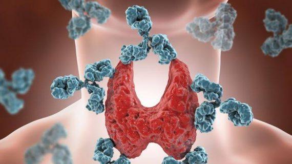 Autoimun Apa Itu Penyakit Apa? Inilah Penyebab dan Gejalanya!