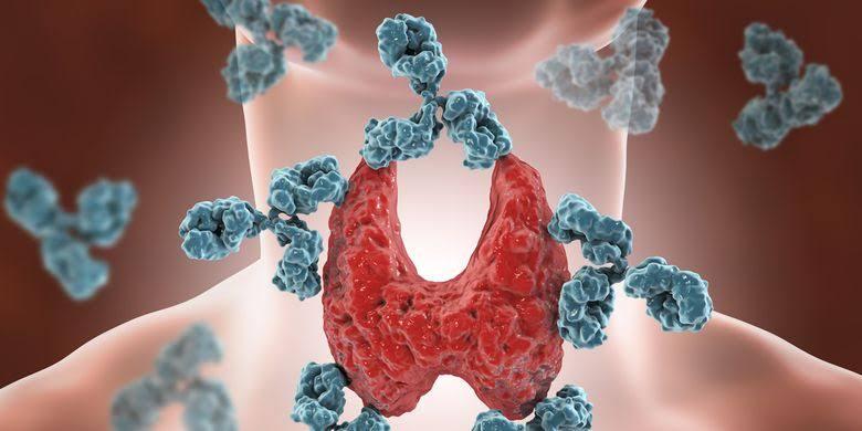 Autoimun Apa Itu Penyakit Apa? Inilah Penyebab dan Gejalanya