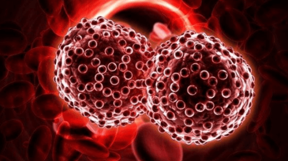 13 Gejala Kanker Darah yang Wajib Diketahui