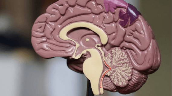 5 Penyebab Tumor Otak yang Harus Diwaspadai