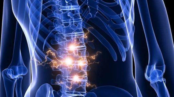 Berenang Dapat Mengatasi Saraf Kejepit