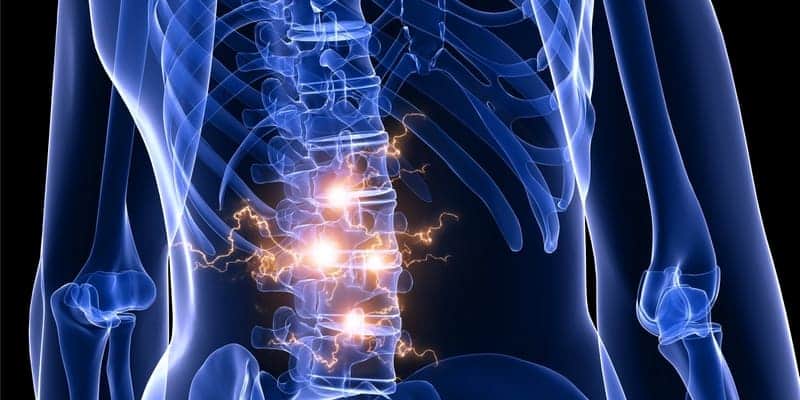 Berenang Dapat Mengatasi Saraf Kejepit