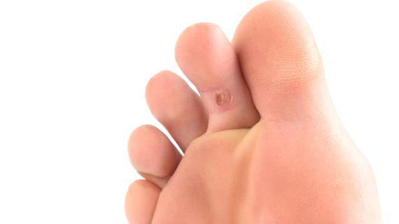 Cara Tradisional Sembuhkan Mata Ikan