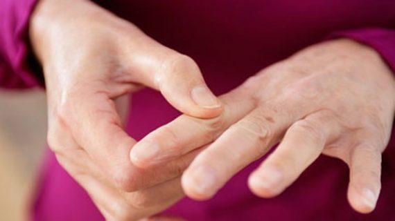 Pengobatan Tradisional Penyakit Lupus