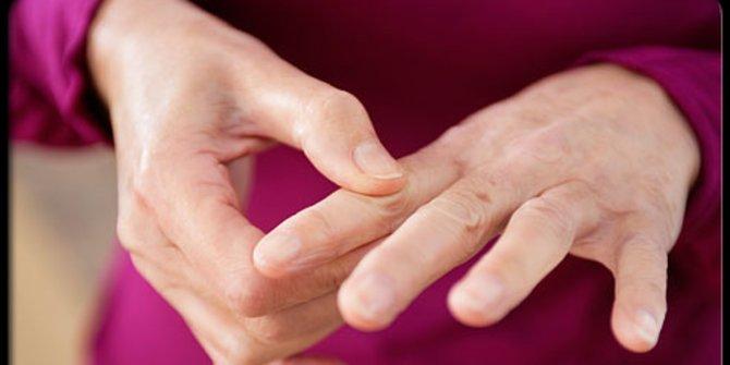 Pengobatan Tradisional Penyakit Lupus