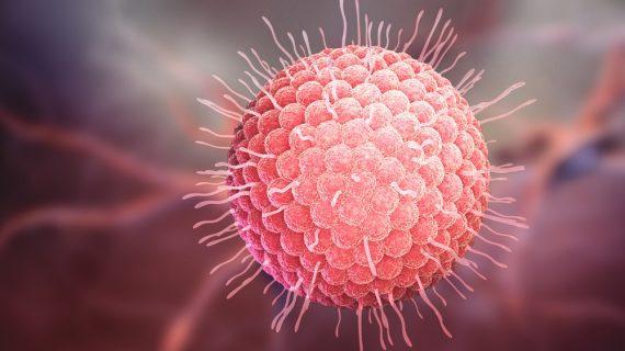 Penyembuhan Cacar Air Secara Alami