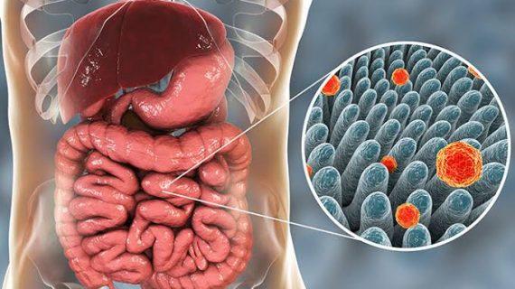 Mencegah Penularan Penyakit Hepatitis