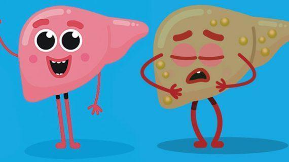 Penanganan dan Langkah Pencegahan Hepatitis A