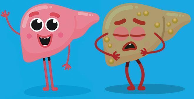 Penanganan dan Langkah Pencegahan Hepatitis A