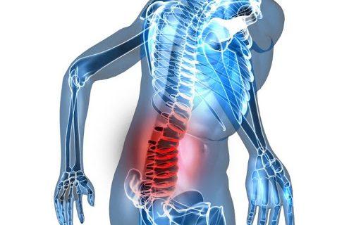 Beberapa Terapi yang Cocok untuk Pengobatan Syaraf Kejepit (HNP) dan Jantung