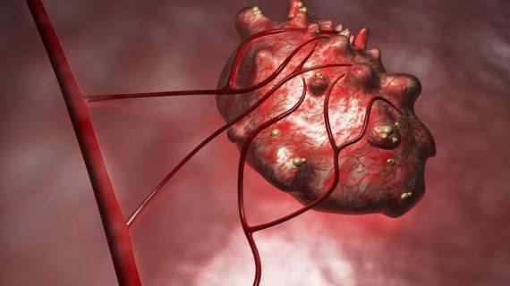 Manfaat Tumbuhan Alami Untuk Mengatasi Penyakit Tumor