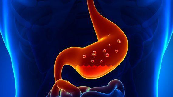 Terapi GERD Tanpa Obat Kimia Yang Dapat Dilakukan di Rumah