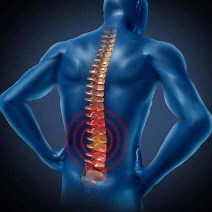 Sedang Pengobatan Syaraf Kejepit (HNP) dan Jantung? Apa Saja Pantangannya?