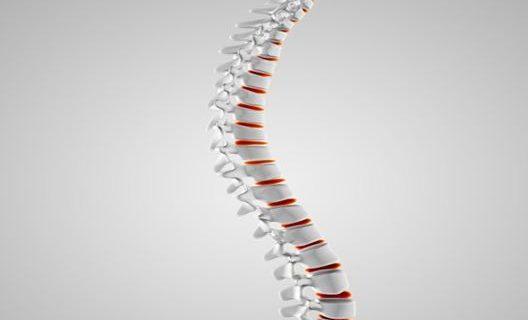 Mengetahui Penyebab serta Gejala Skoliosis