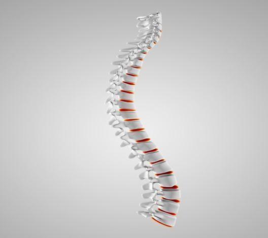 Mengetahui Penyebab serta Gejala Skoliosis
