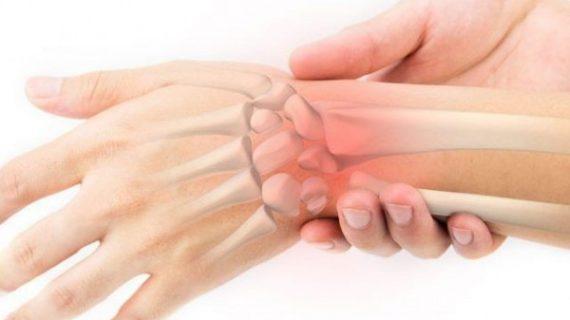Mengetahui Penyebab dan Cara Pengobatan Carpal Tunnel Syndrome