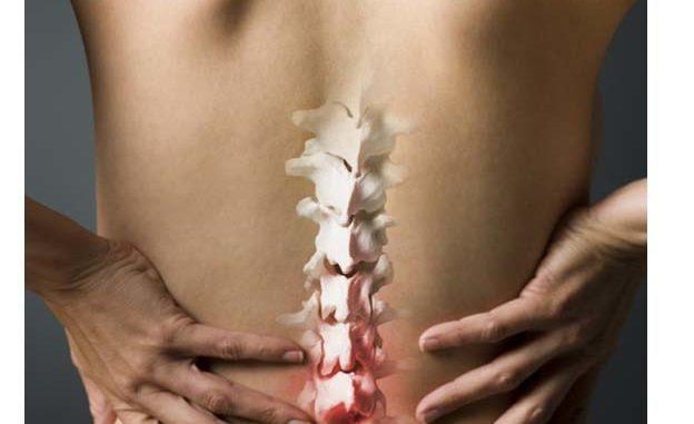 Berbagai Pantangan Jika Mengalami Syaraf Kejepit Yang Sebaiknya Di Hindari