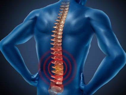 Cara Yang Dapat Dilakukan Untuk Mencegah Timbulnya Syaraf Kejepit