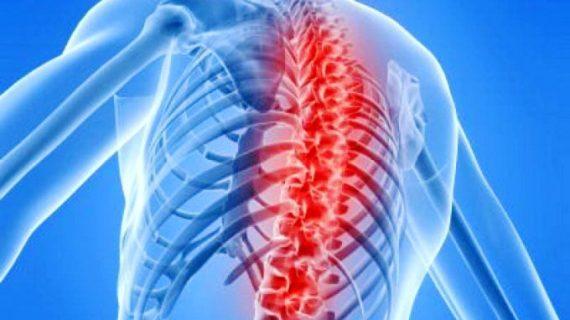 Faktor Penyebab Serta Pengobatan Syaraf Kejepit yang Dilakukan Secara Alami