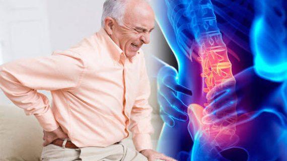 Tempat Pengobatan Syaraf Kejepit Bandung Terpercaya, Atasi Berbagai Keluhan Syaraf Kejepit