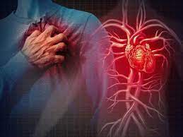 Pengobatan Jantung Tanpa Operasi, Terapi PAZ di Bali