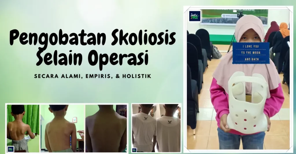 terapi skoliosis pengobatan skoliosis selain operasi