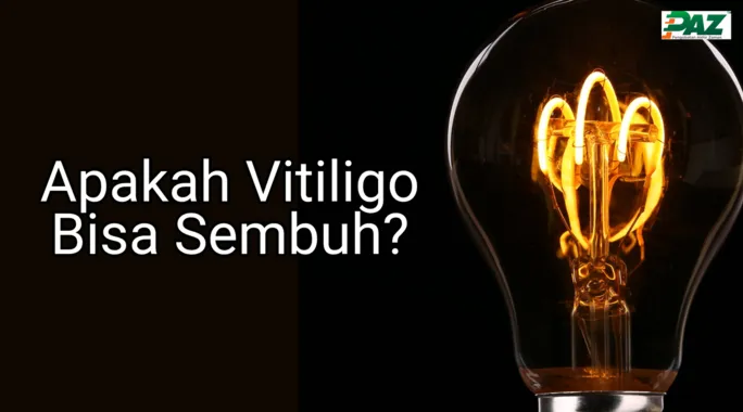 vitiligo bisa sembuh paz al kasaw