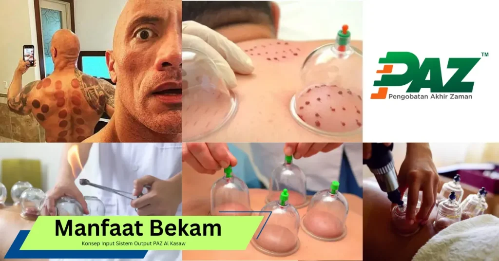Manfaat Bekam Ditinjau dari Konsep Input Sistem Output PAZ
