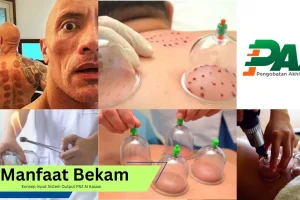 Manfaat Bekam Ditinjau dari Konsep Input Sistem Output PAZ