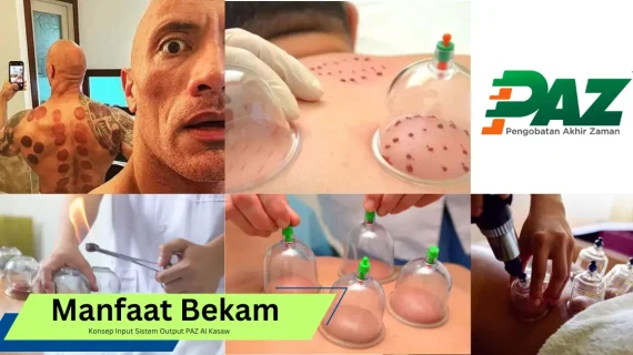 Manfaat Bekam Ditinjau dari Konsep Input Sistem Output PAZ