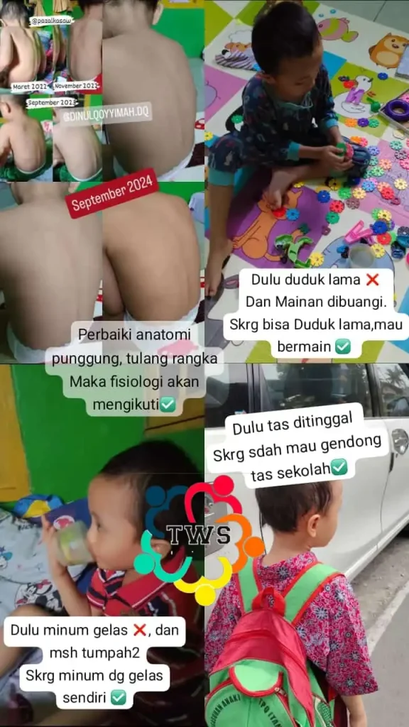 tempat terapi autis klaten pengobatan autisme webp