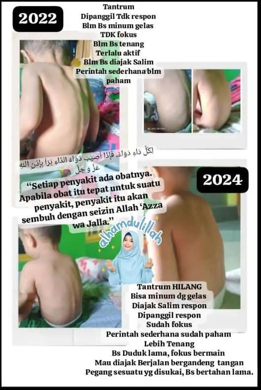terapi atst autis terapi autis secara islami webp