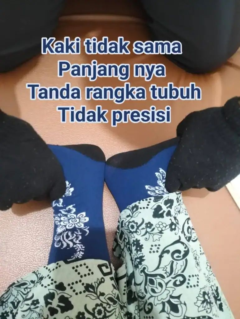 Kaidah Anamnesa Pemeriksaan Visual Kaki PAZ Apakah KB Bisa Menyebabkan Kanker